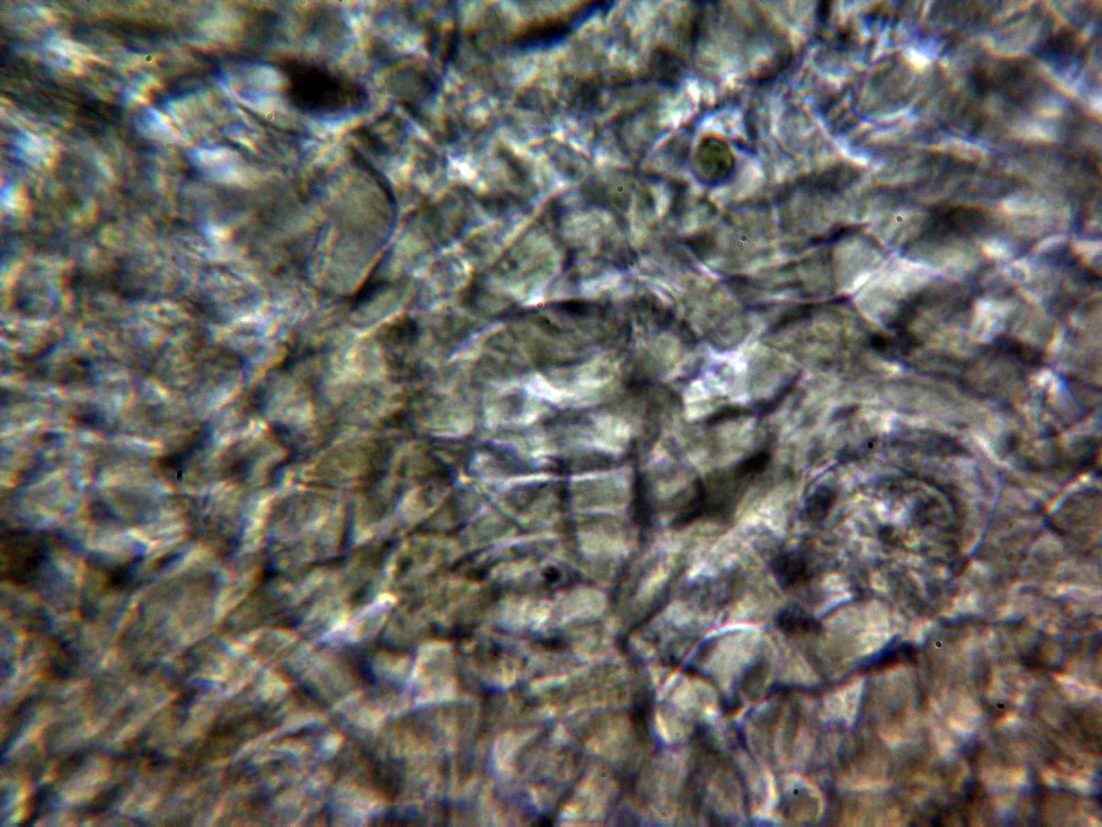 10 - Excípulo medular Melzer
